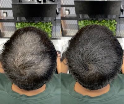 The HairBear Filler Powder