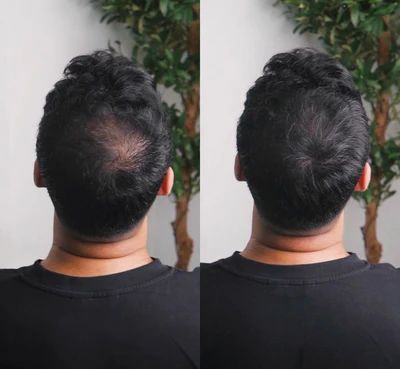 The HairBear Filler Powder