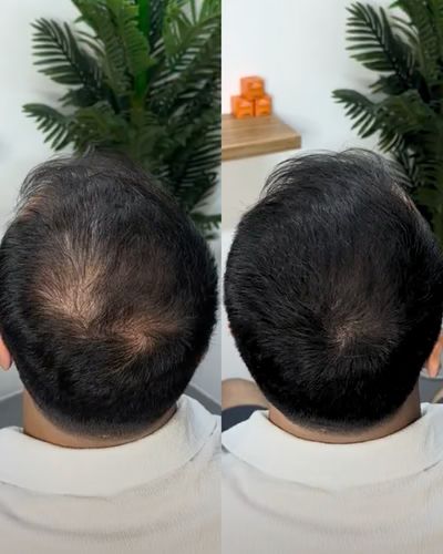 The HairBear Filler Powder