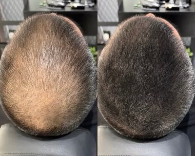 The HairBear Filler Powder