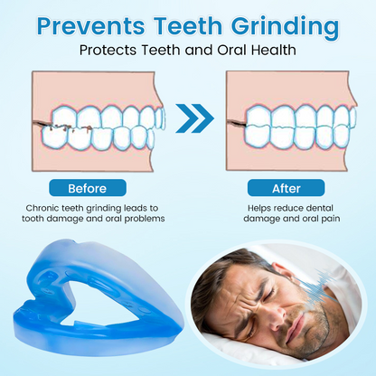 The Anti-Snoring (Teeth Grind Protector)