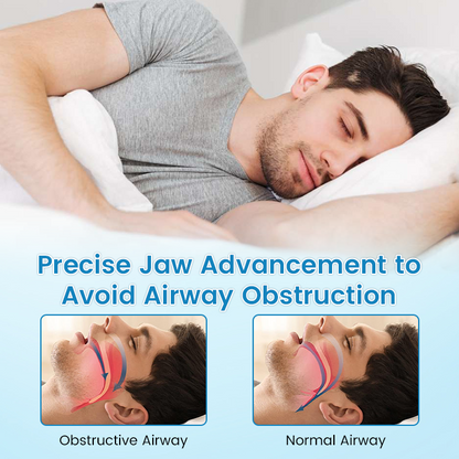 The Anti-Snoring (Teeth Grind Protector)